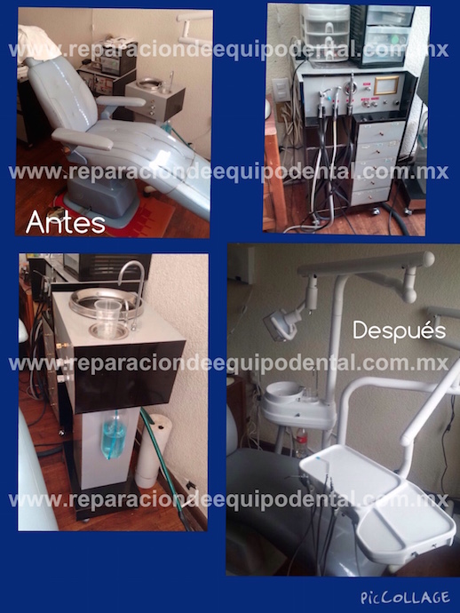 Remodelación de equipo dental